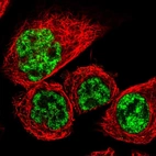 Immunofluorescent staining of human cell line A-431 shows localization to nuclear speckles.