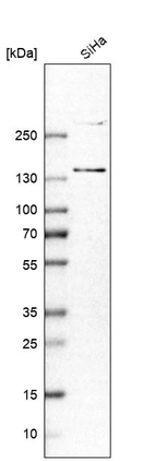 Western blot analysis in human cell line SiHa.