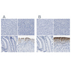 Immunohistochemical staining of human liver, pancreas, stomach and urinary bladder using Anti-UPK3A antibody HPA018407 (A) shows similar protein distribution across tissues to independent antibody HPA018415 (B).