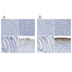 Immunohistochemical staining of human liver, pancreas, stomach and urinary bladder using Anti-UPK3A antibody HPA018407 (A) shows similar protein distribution across tissues to independent antibody HPA018415 (B).