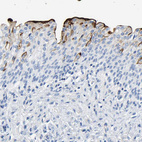 Immunohistochemical staining of human urinary bladder shows strong cytoplasmic positivity in urothelial cells.