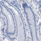 Immunohistochemical staining of human stomach shows no positivity in glandular cells as expected.