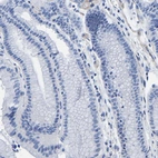 Immunohistochemical staining of human stomach shows no positivity in glandular cells as expected.