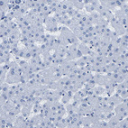 Immunohistochemical staining of human liver shows no positivity in hepatocytes as expected.