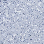 Immunohistochemical staining of human liver shows no positivity in hepatocytes as expected.