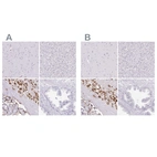 Immunohistochemical staining of human cerebral cortex, liver, placenta and prostate using Anti-PAPPA2 antibody HPA018412 (A) shows similar protein distribution across tissues to independent antibody HPA018430 (B).