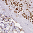 Immunohistochemical staining of human placenta shows moderate cytoplasmic positivity in trophoblastic cells.