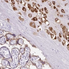 Immunohistochemical staining of human placenta shows moderate cytoplasmic positivity in trophoblastic cells.