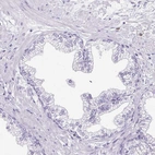 Immunohistochemical staining of human prostate shows no positivity in glandular cells as expected.