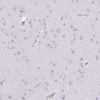Anti-PAPPA2 Antibody