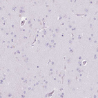 Immunohistochemical staining of human cerebral cortex shows no positivity in neurons as expected.