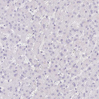 Immunohistochemical staining of human liver shows no positivity in hepatocytes as expected.