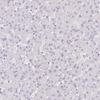 Immunohistochemical staining of human liver shows no positivity in hepatocytes as expected.