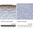Anti-UPK3A Antibody