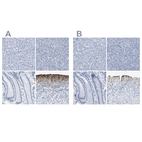 Immunohistochemical staining of human liver, pancreas, stomach and urinary bladder using Anti-UPK3A antibody HPA018415 (A) shows similar protein distribution across tissues to independent antibody HPA018407 (B).