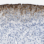 Immunohistochemical staining of human urinary bladder shows strong cytoplasmic positivity in urothelial cells.