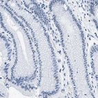 Immunohistochemical staining of human stomach shows no positivity in glandular cells as expected.