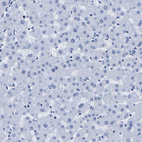 Immunohistochemical staining of human liver shows no positivity in hepatocytes as expected.