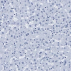 Immunohistochemical staining of human liver shows no positivity in hepatocytes as expected.