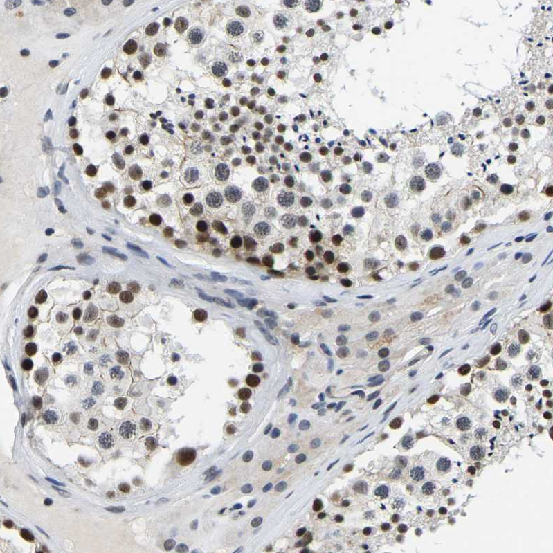 Anti-POLDIP3 Antibody