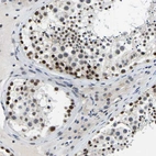 Anti-POLDIP3 Antibody