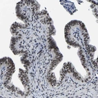 Immunohistochemical staining of human fallopian tube shows moderate nuclear positivity in glandular cells.