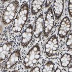 Immunohistochemical staining of human rectum shows moderate nuclear-cytoplasmic positivity in glandular cells.