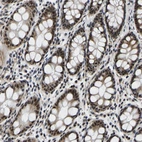 Immunohistochemical staining of human rectum shows moderate nuclear-cytoplasmic positivity in glandular cells.