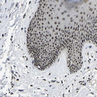 Immunohistochemical staining of human skin shows moderate nuclear positivity in squamous epithelial cells.