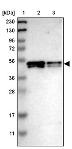 Lane 1: Marker [kDa] 230, 130, 95, 72, 56, 36, 28, 17, 11_br/_Lane 2: Human cell line RT-4_br/_Lane 3: Human cell line U-251MG sp