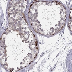 Anti-RSPH14 Antibody