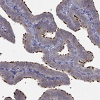 Immunohistochemical staining of human fallopian tube shows strong positivity in cilia in glandular cells.