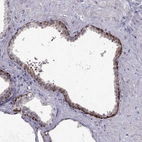 Immunohistochemical staining of human prostate shows strong cytoplasmic positivity in basal cells.