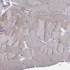 Immunohistochemical staining of human skeletal muscle shows weak cytoplasmic positivity in myocytes.
