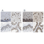 Immunohistochemical staining of human cerebellum, cerebral cortex, skin and testis using Anti-G3BP2 antibody HPA018425 (A) shows similar protein distribution across tissues to independent antibody HPA018304 (B).