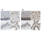 Immunohistochemical staining of human cerebellum, cerebral cortex, skin and testis using Anti-G3BP2 antibody HPA018425 (A) shows similar protein distribution across tissues to independent antibody HPA018304 (B).