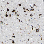 Immunohistochemical staining of human cerebral cortex shows strong cytoplasmic positivity in neuronal cells.
