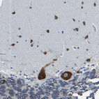 Immunohistochemical staining of human cerebellum shows strong cytoplasmic positivity in Purkinje cells and cells in molecular layer.