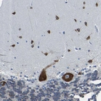Immunohistochemical staining of human cerebellum shows strong cytoplasmic positivity in Purkinje cells and cells in molecular layer.