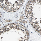 Immunohistochemical staining of human testis shows moderate cytoplasmic positivity in cells in seminiferous ducts and Leydig cells.
