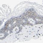 Immunohistochemical staining of human skin shows very weak cytoplasmic positivity in epidermal cells.