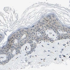 Immunohistochemical staining of human skin shows very weak cytoplasmic positivity in epidermal cells.