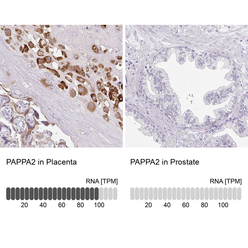 Anti-PAPPA2 Antibody