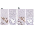 Immunohistochemical staining of human cerebral cortex, liver, placenta and prostate using Anti-PAPPA2 antibody HPA018430 (A) shows similar protein distribution across tissues to independent antibody HPA018412 (B).
