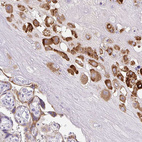 Immunohistochemical staining of human placenta shows moderate cytoplasmic positivity in trophoblastic cells.