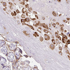 Anti-PAPPA2 Antibody