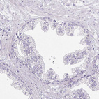 Immunohistochemical staining of human prostate shows no positivity in glandular cells as expected.