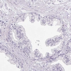 Immunohistochemical staining of human prostate shows no positivity in glandular cells as expected.