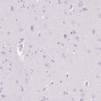 Immunohistochemical staining of human cerebral cortex shows no positivity in neurons as expected.