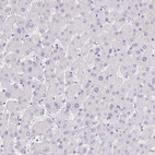 Immunohistochemical staining of human liver shows no positivity in hepatocytes as expected.